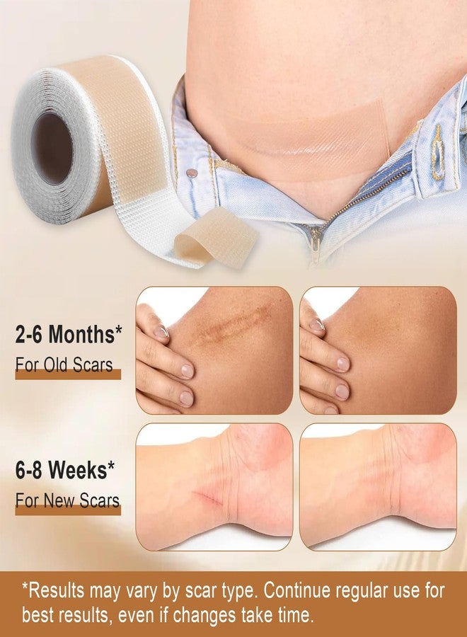 Jconly Silicone Scar Sheets for C-Section & Surgery - 2M Roll (1.6"x80") - Reusable & Hypoallergenic Scar Tape to Fade Scars from Acne, Burns, Keloid | Doctor Recommended - Image 3